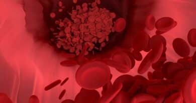Как очистить кровь: Здоровые способы очищения крови