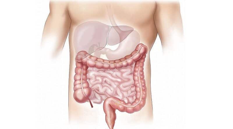 Come affrontare il morbo di Crohn con un trattamento naturale