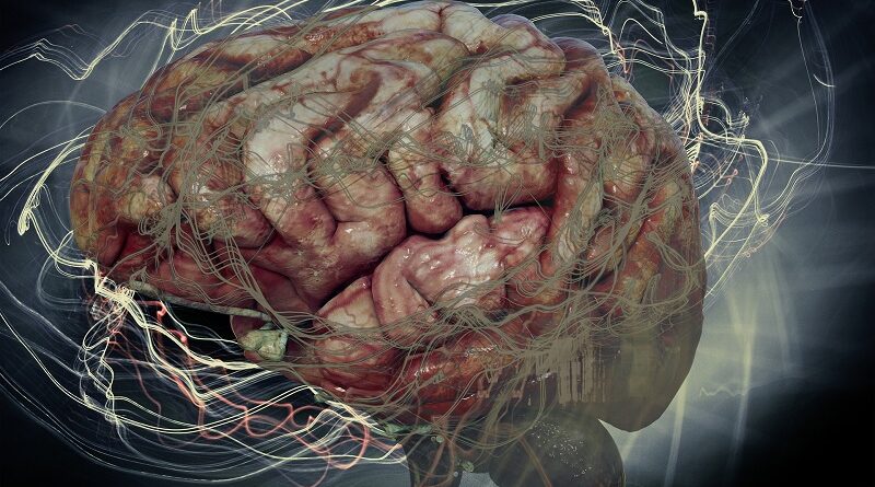 栄養療法が多発性硬化症を遅らせる方法