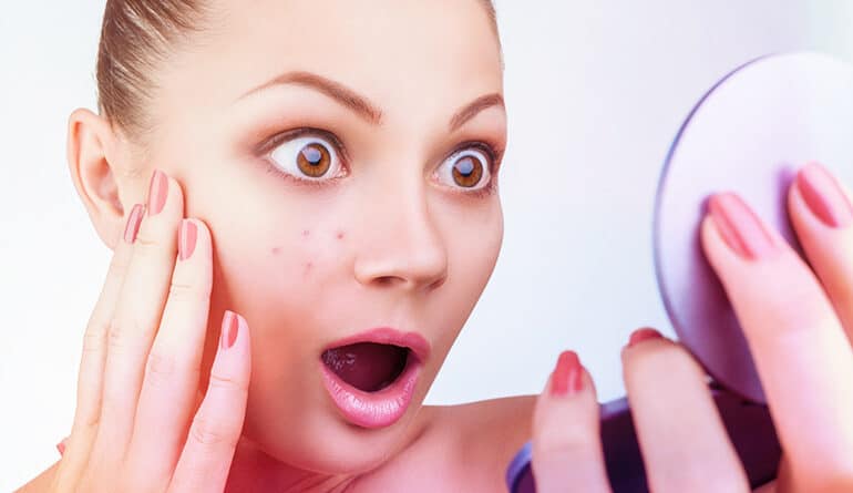 Les différents types de boutons et d'acné révèlent des problèmes de santé