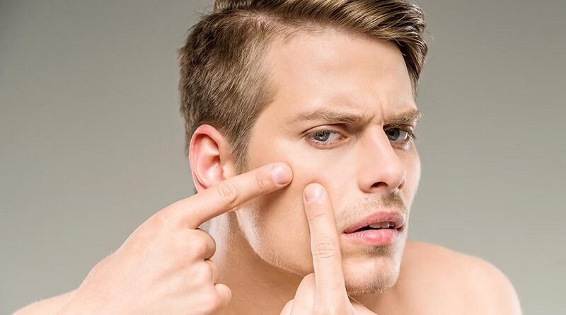 Уход за кожей для мужчин и 6 малоизвестных причин кожных высыпаний