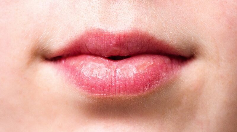 Ангулярный хейлит: Симптомы и причины этого воспалительного заболевания губ